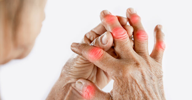 Uloric Gout Medication and Heart Attacks woman holding her hands with arthritis