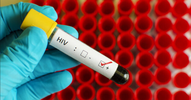 HIV Drugs Update featured image showing a gloved medical technician holding a vial of HIV positive blood against background of red vial holders
